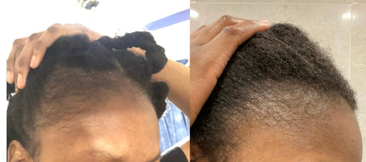 Natural hair consultations